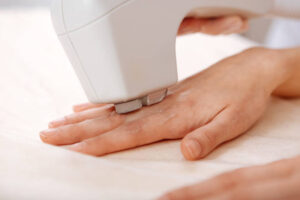 Hands And Fingers Laser Hair Removal