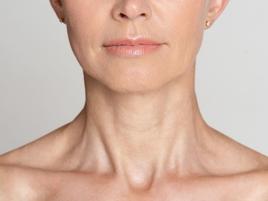 Botox - Edged Vertical Neck Line (Platysmal Bands)