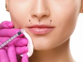 Botox - LIP FLIP & SMOKERS LINES 