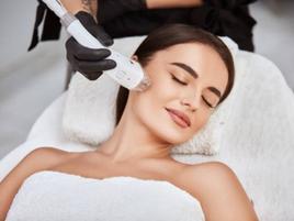 Cheeks Laser Hair Removal