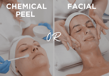 Chemical Peels or Facials; Having a Hard Time Choosing?