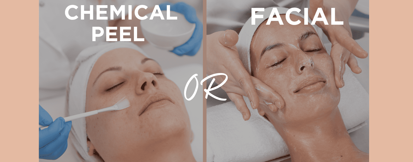 Chemical Peels or Facials; Having a Hard Time Choosing?