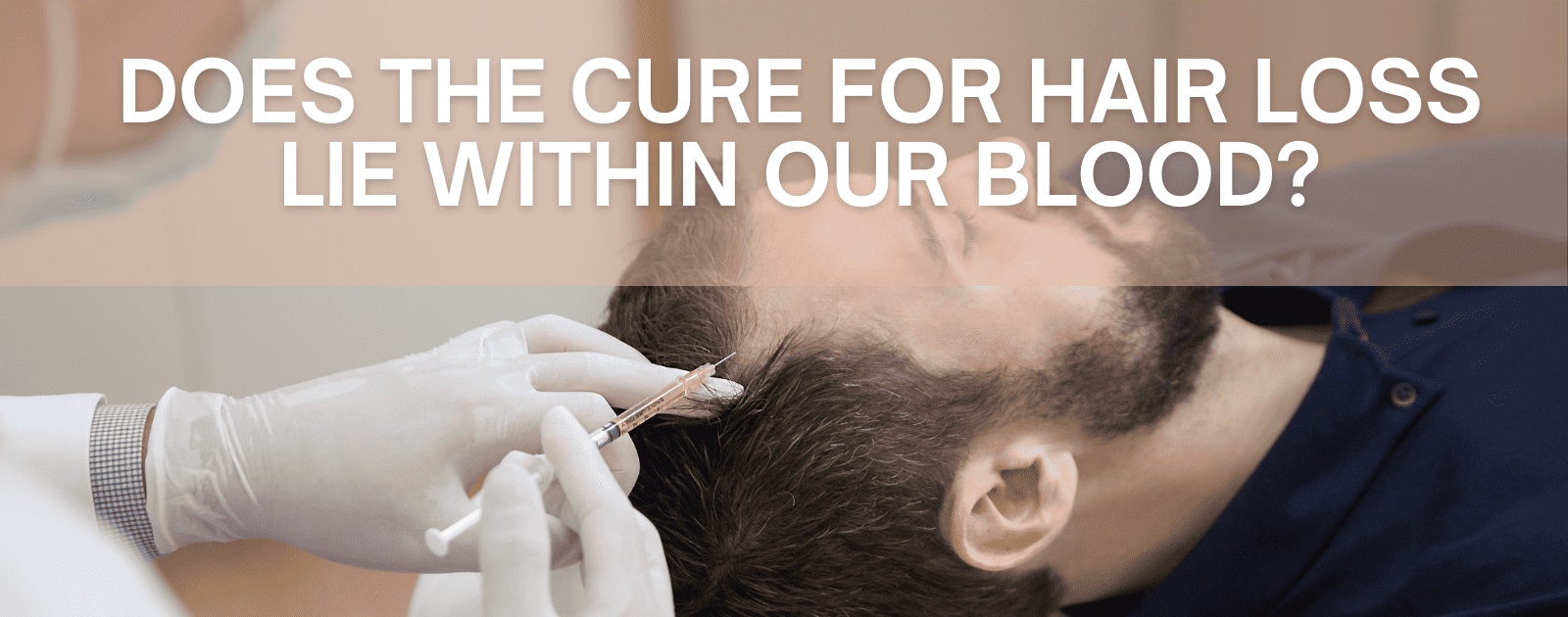 Platelet-Rich-Plasma: Does the cure for hair loss lie within our blood?