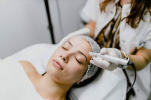Microneedling full face with NCTF Skin Booster